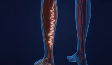 smart ways modern clinics handle varicose veins