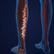 smart ways modern clinics handle varicose veins
