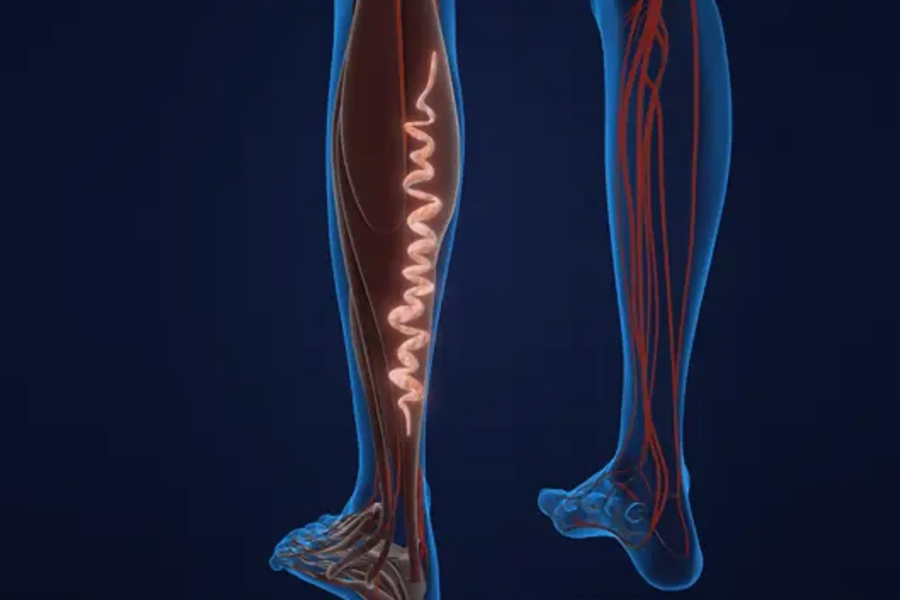 smart ways modern clinics handle varicose veins