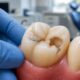 When a Tooth Needs More Than a Filling