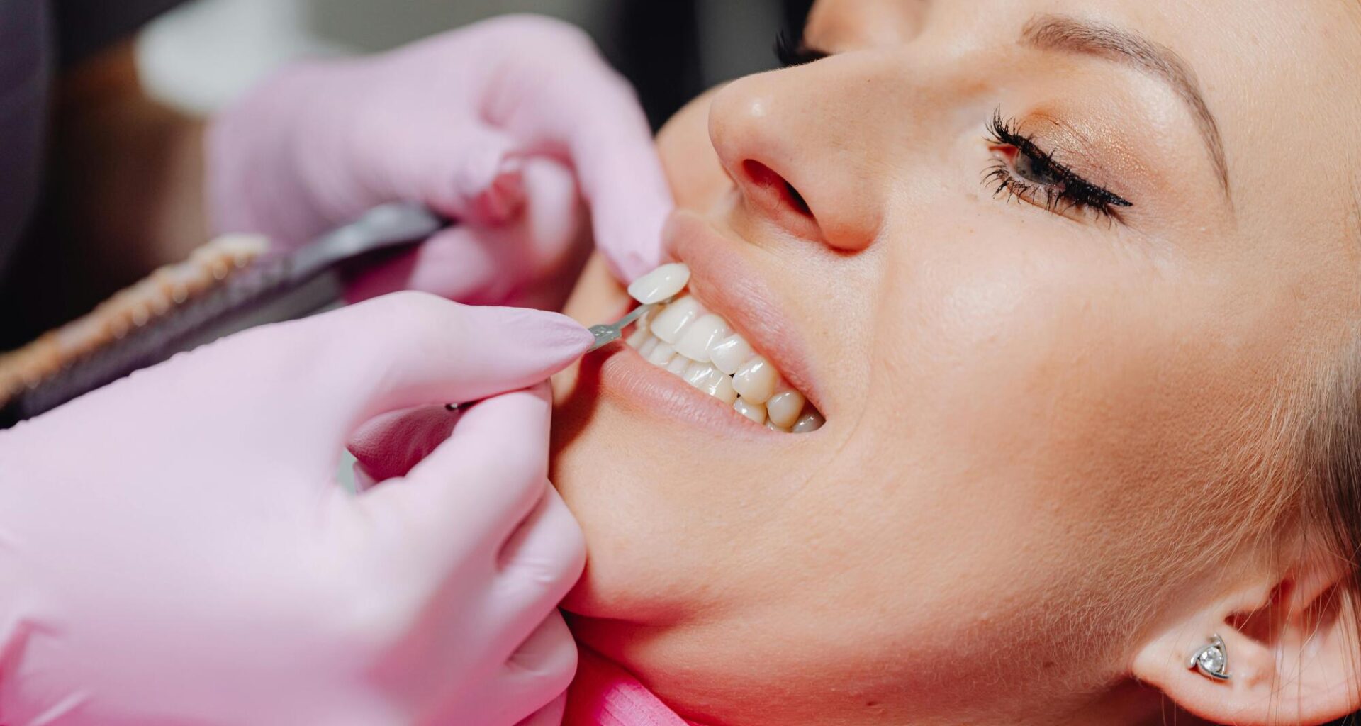 The Coverage Details Patients Often Miss Before Dental Treatment