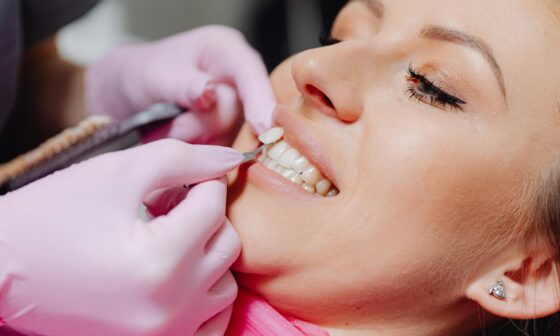 The Coverage Details Patients Often Miss Before Dental Treatment